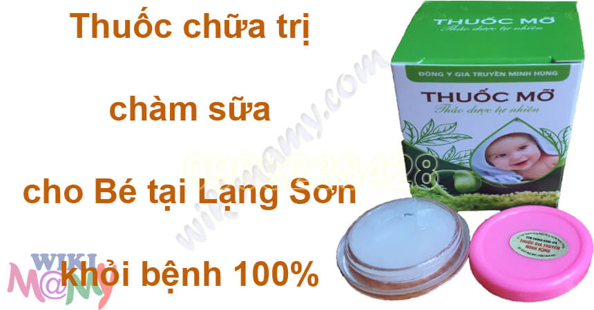 Thuốc chữa trị chàm sữa cho Bé tại Lạng Sơn khỏi bệnh 100%
