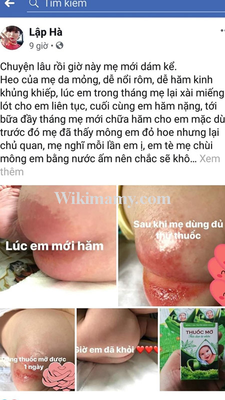 phản hổi về thuốc mỡ minh hùng tại lạng sơn